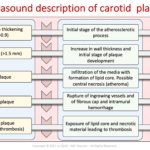 Carotid Course Info | Abc Vascular Regarding Carotid Ultrasound Report Template